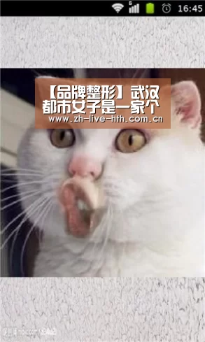 【品牌整形】武汉都市女子是一家个性及特色的医院“棋牌赛事”(图4) 华体会